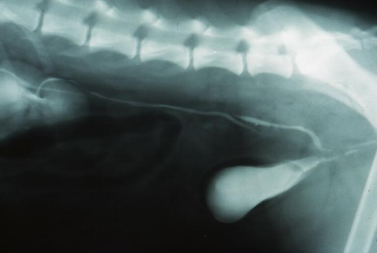 Fig. 8 Ureteri ectopici extramurali bilaterali diagnosticati tramite urografia endovenosa discendente