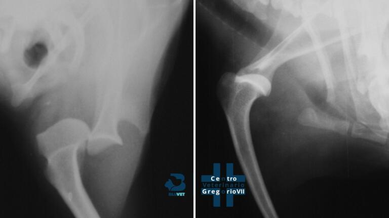 Rx lussazione di spalla