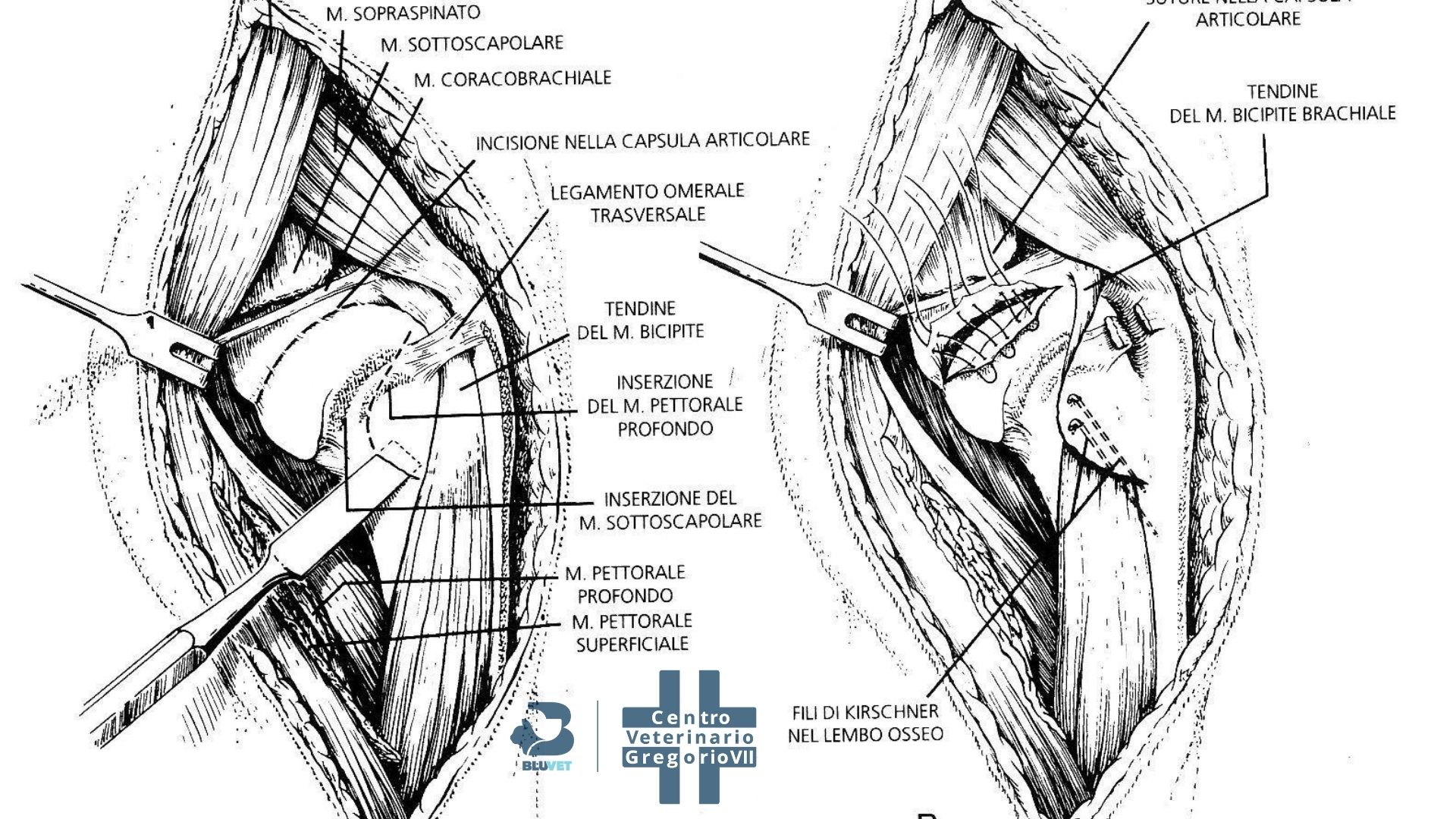 lussazione di spalla lastra schema intervento