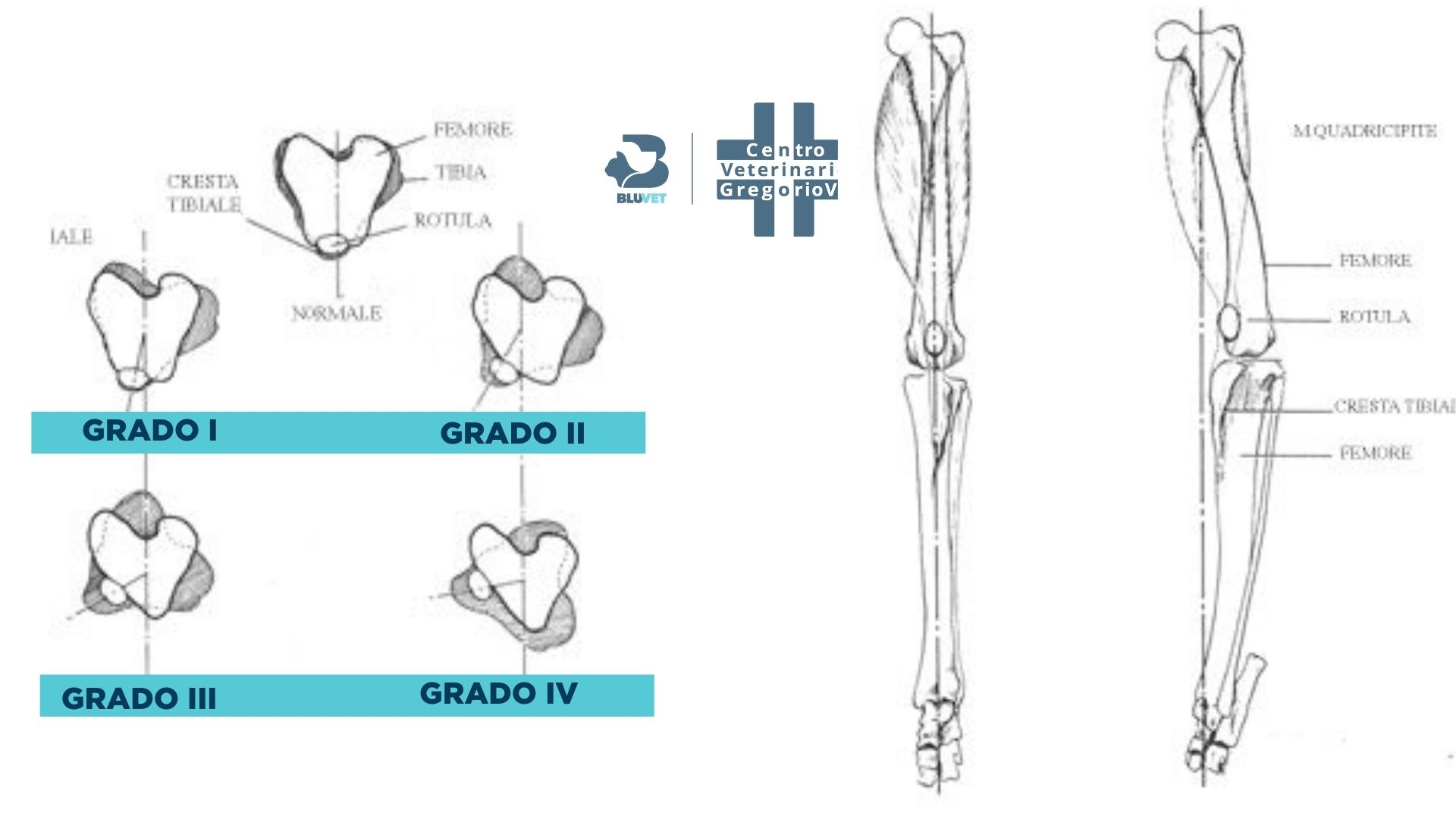 lussazione rotulea schema gradi