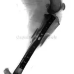 frattura tibia cane dopo chirurgia