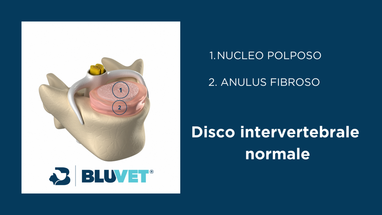 Disco intervertebrale normale